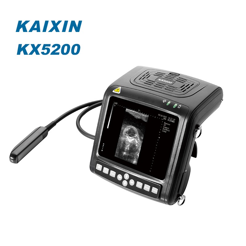XUZHOU KAIXIN ELECTRONIC INSTRUMENT CO., LTD – bicicleta de montaña 3